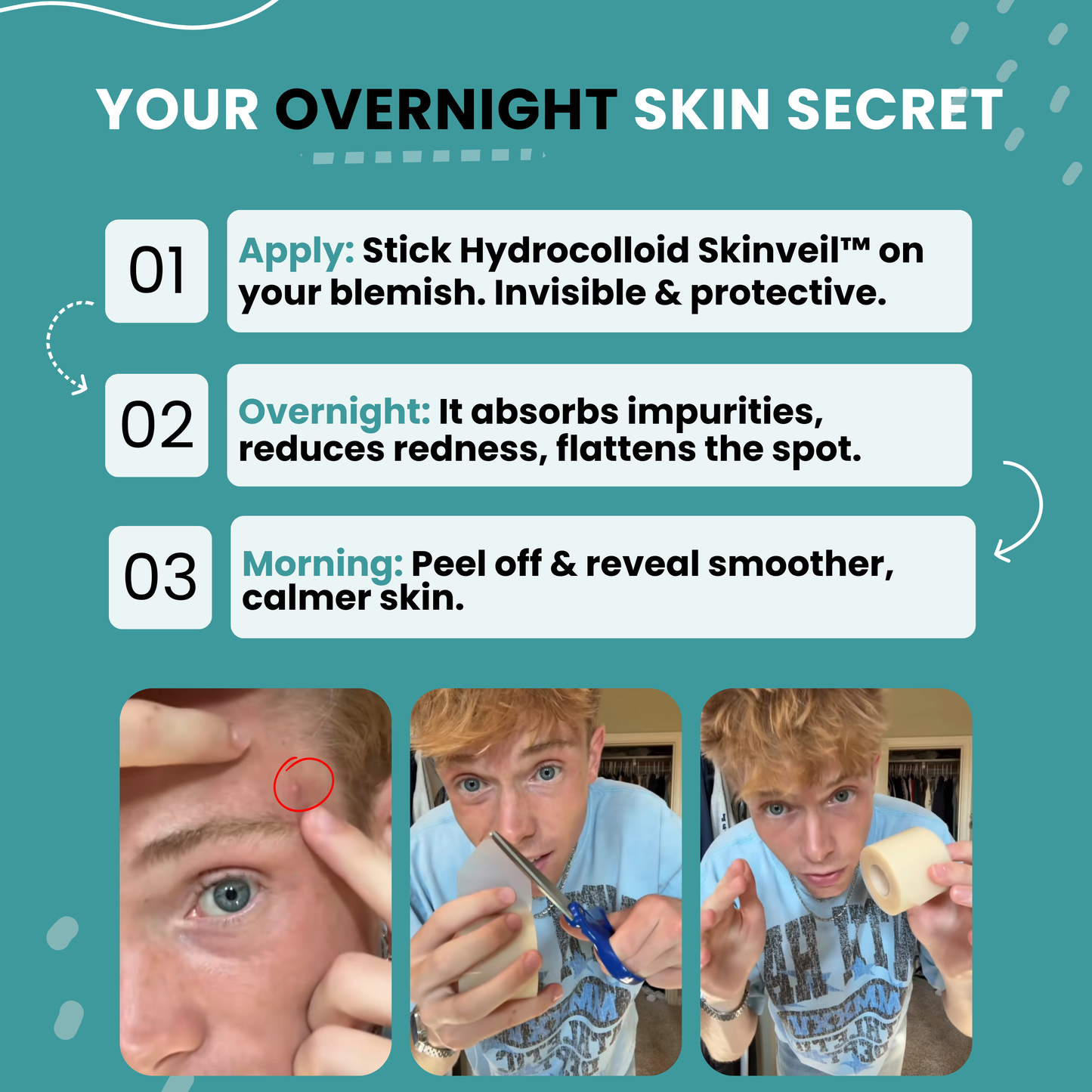 Hydrocolloid Skinveil™