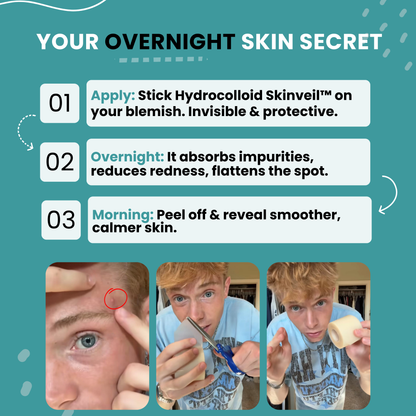 Hydrocolloid Skinveil™